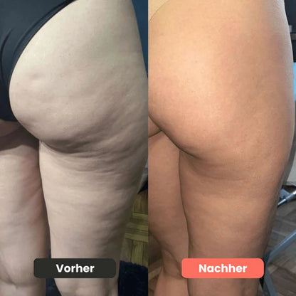 Dekcan Cellugone V2 - Sichtbar glattere & straffere Haut