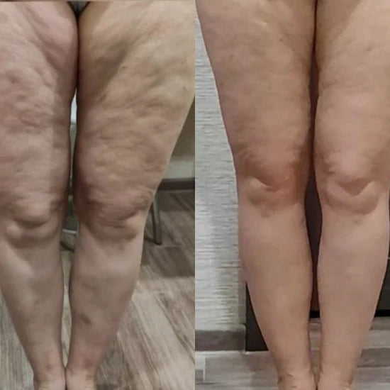 Dekcan - Cellu Infrarot-Wärme-Anti-Cellulite-Gerät