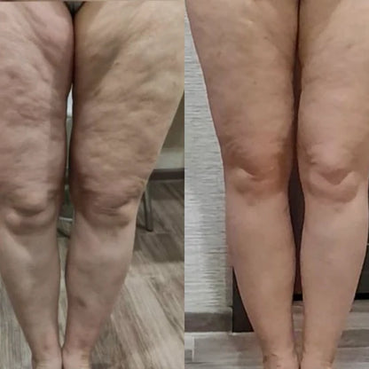 Dekcan - Cellu Infrarot-Wärme-Anti-Cellulite-Gerät