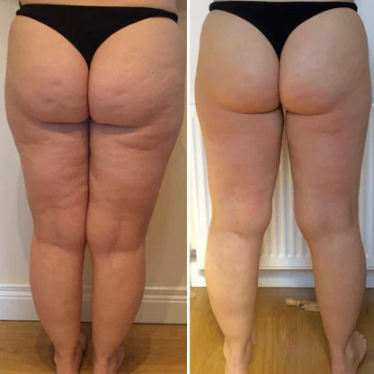 Dekcan - Cellu Infrarot-Wärme-Anti-Cellulite-Gerät