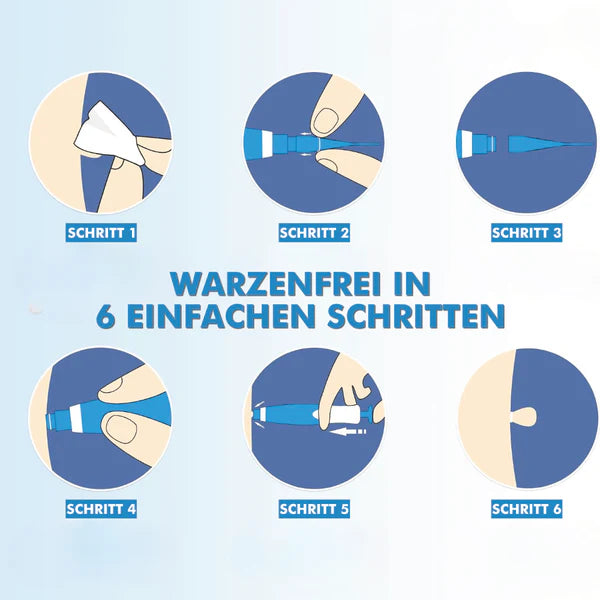 Warzenfrei   PRO   -   Der   Professionelle   Stielwarzen   Entferner