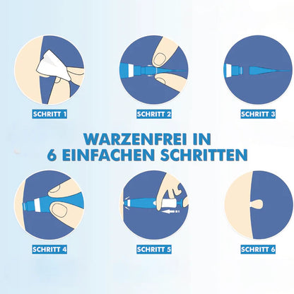 Warzenfrei   PRO   -   Der   Professionelle   Stielwarzen   Entferner